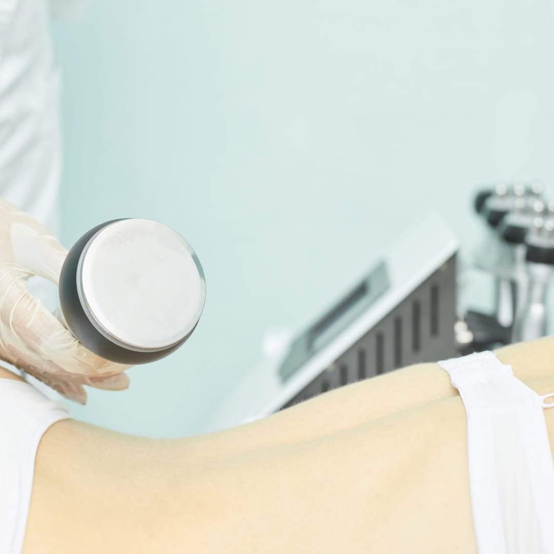CAVITATION